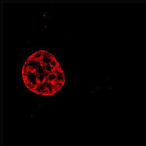 AIE细胞核红色探针/固定细胞染色/聚集诱导发光特性/多次成像