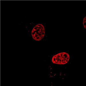 AIE细胞核红色探针,AIE Red Probe for Nucleus