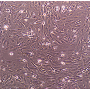 人整合SV40基因的乳腺上皮细胞HBL100,HBL100