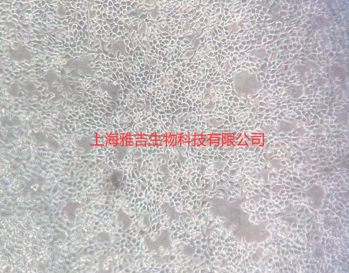 人非小细胞肺癌细胞HCC827/LUC,HCC827/LUC