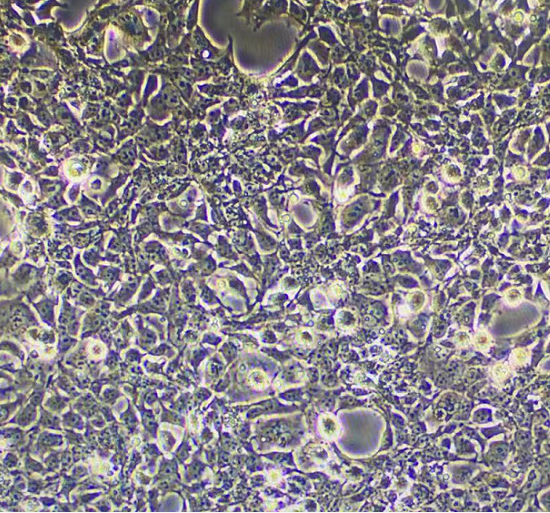人乳腺癌细胞（非三阴）Her2阴性,MCF7