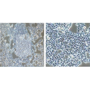 人卵巢透明细胞癌细胞ES2