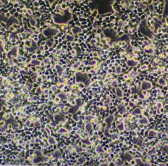 人眼膜络黑色素瘤细胞OCM1A,OCM1A