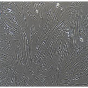 人骨髓浆细胞瘤株AMO1,AMO1