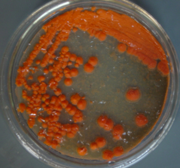皂黏土寡养单胞菌,Stenotrophomonas Bentonitica