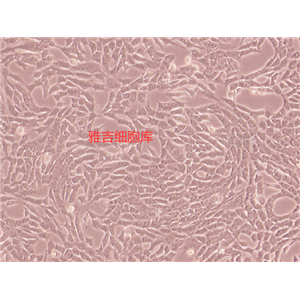 人肺腺癌细胞HCC95