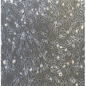 人乳腺癌细胞（三阴性）CAL51