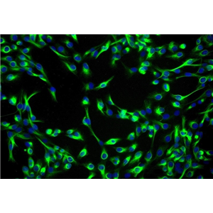 人骨髓基质成纤维细胞HS27A