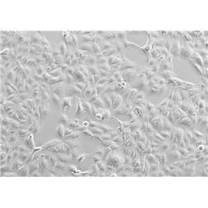 大鼠肾小球系膜细胞HBZY1
