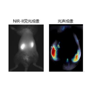 肾纤维化诊断 NIR-II AIE 探针