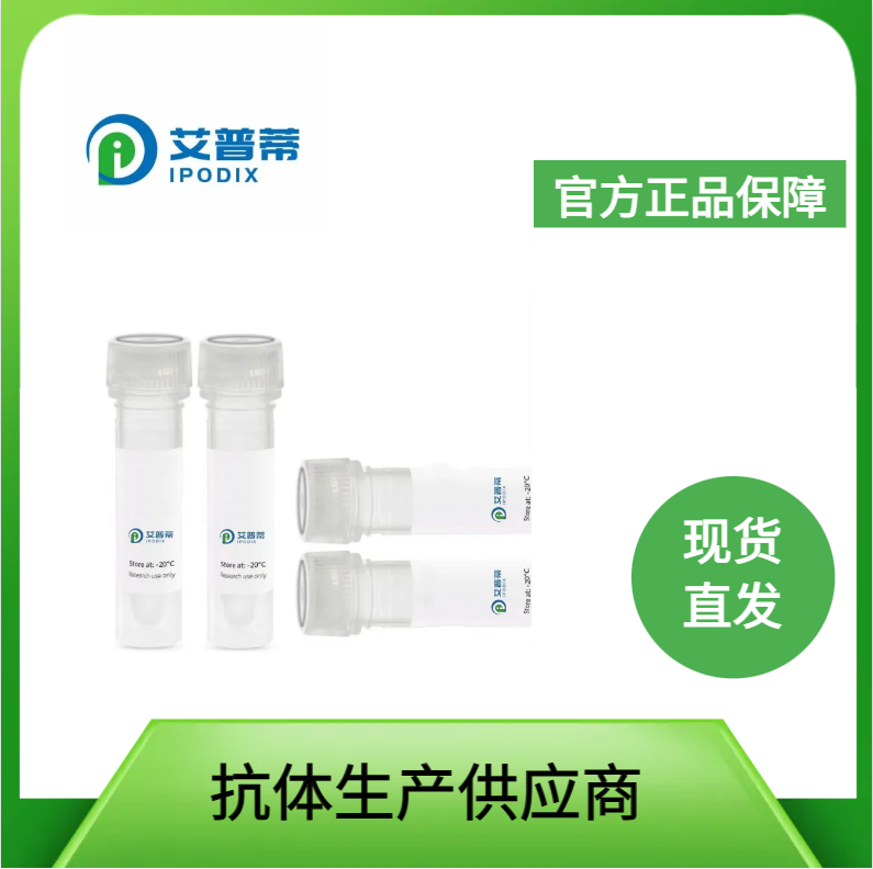 SLC25A12抗體；SLC25A12 antibody,SLC25A12 antibody