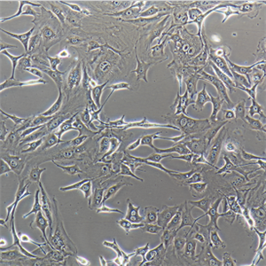 小鼠皮下結(jié)締組織細(xì)胞L-cell