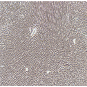 人慢性粒细胞白血病细胞KCL22