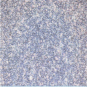Hepa1-6/LUC/GFP-Puro双标记的小鼠肝癌细胞
