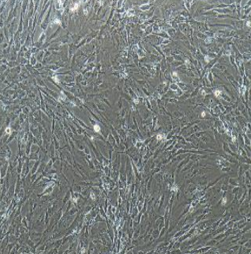 急性T淋巴细胞白血病细胞TALL104,TALL104