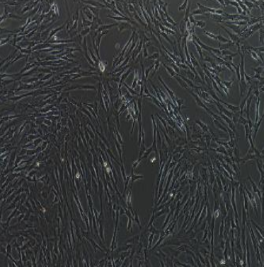 人神经胶质瘤细胞LN18,LN18