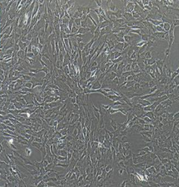H82狗肾恶性组织细胞增生症细胞,H82