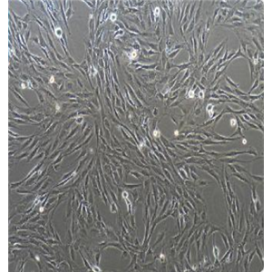 人神经胶质母细胞瘤U343