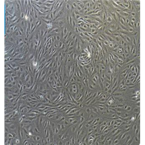 视网膜Muller干细胞MIOM1