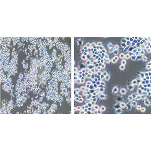 大鼠肾上腺嗜铬细胞瘤细胞PC-12(高分化)
