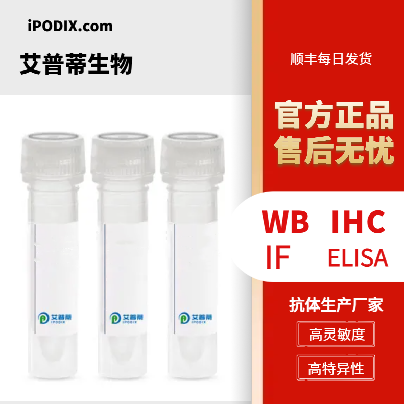 RDX蛋白抗體；RDX antibody,RDX antibody