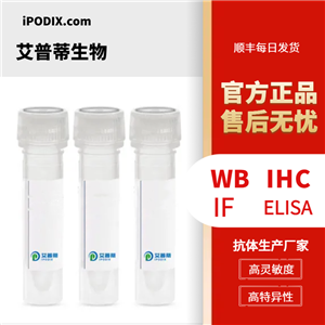 RDX蛋白抗体；RDX antibody 艾普蒂生物              