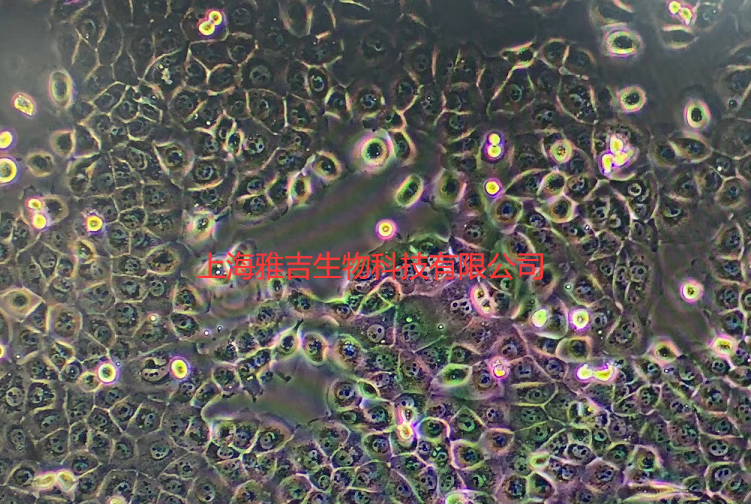 荧光素酶/GFP标记的人卵巢癌细胞OVCAR3/LUC/GFP,ovcar3/LUC/GFP