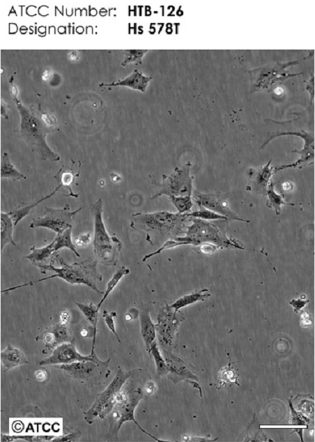 荧光素酶标记的人食管鳞癌细胞KYSE-150/LUC,kyse150/LUC