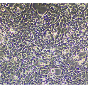 荧光素酶/GFP标记的人多发性骨髓瘤细胞MM.1S/LUC/GFP