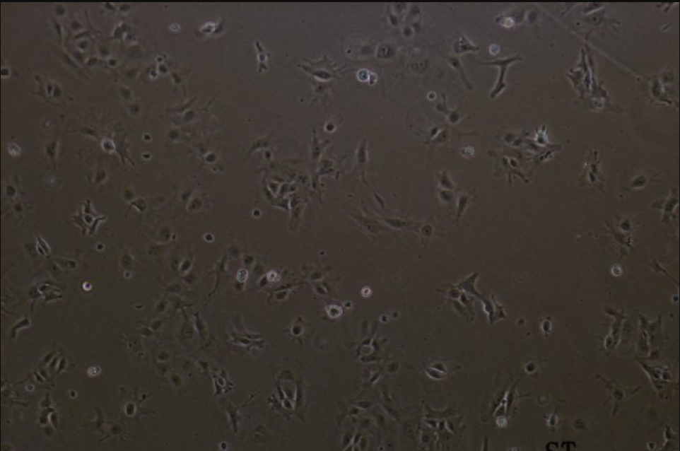 人B淋巴母细胞ICHX-C005I,ichxc005i