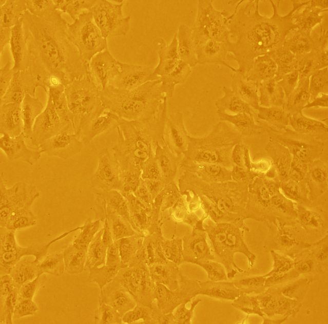 脾细胞骨髓瘤细胞融合细胞TE4,te4