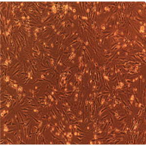 荧光素酶标记的人膀胱癌细胞TCCSUP/LUC