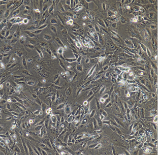 人肺癌细胞(淋巴结转移)NCI-H292/LUC-E/GFP,ncih292/LUCe/GFP