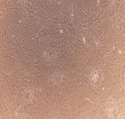 SK-OV-3-e/GFP/LUC人卵巢癌细胞-绿色荧光蛋白-荧光素酶标记,panc1e/GFP/LUCpuro