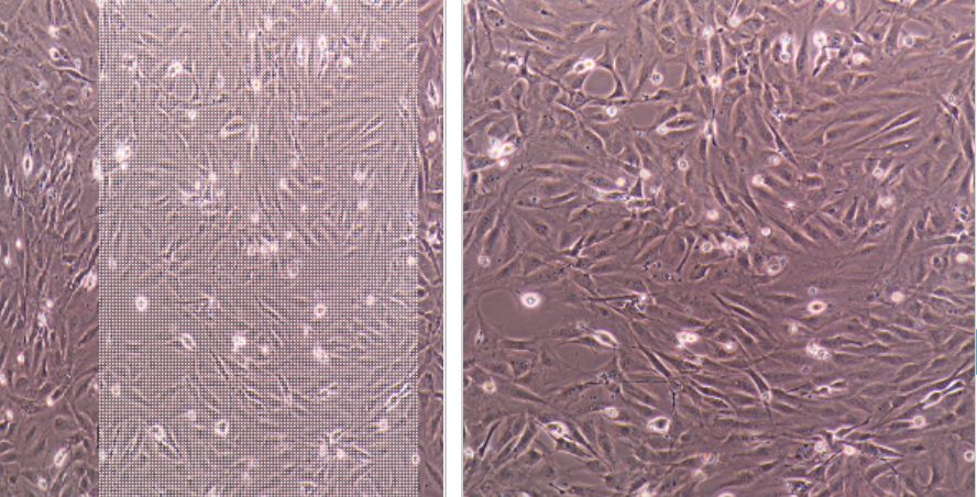 MKN-45-e/GFP/LUC人胃癌細胞-綠色熒光蛋白-熒光素酶標記,mkn45e/GFP/LUC