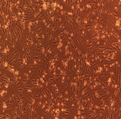 人肾透明细胞腺癌细胞786-0,786-0