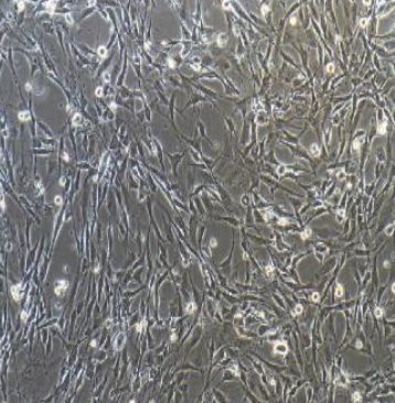 人胚胎肾细胞HEK293S GnTI-,HEK293SGnTI