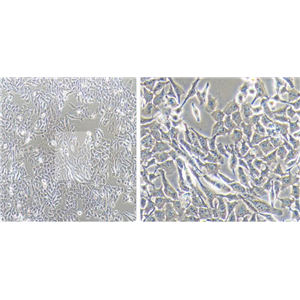 人间变性大细胞淋巴瘤细胞SR786