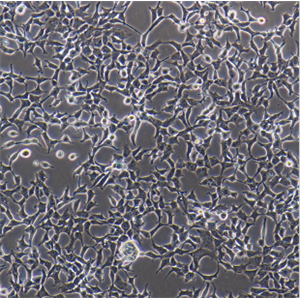 人恶性黑色素瘤细胞A375/LUC-E/GFP,a375/LUCe/GFP