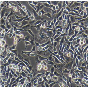 人结肠腺癌细胞RKO/LUC-E/GFP