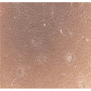 SK-OV-3-e/GFP/LUC人卵巢癌细胞-绿色荧光蛋白-荧光素酶标记