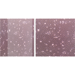MKN-45-e/GFP/LUC人胃癌细胞-绿色荧光蛋白-荧光素酶标记