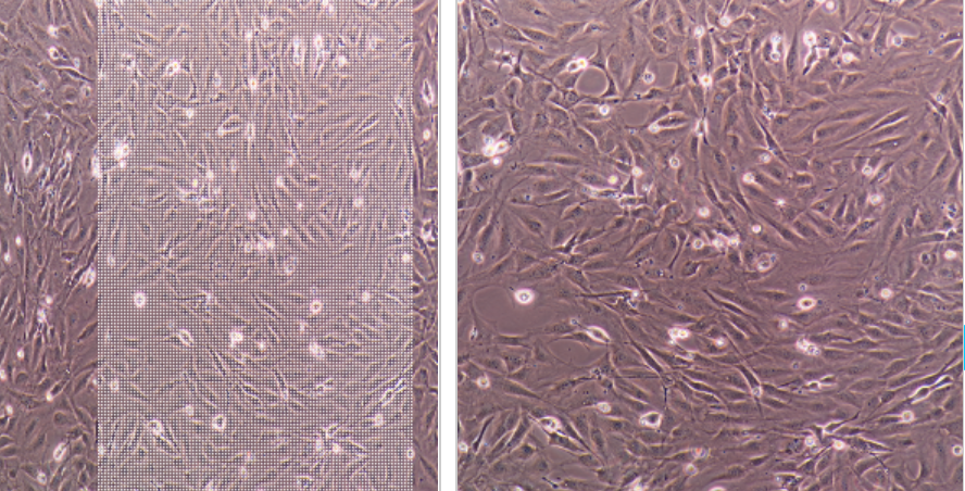 小鼠皮下结缔组织细胞LM(TK),LM
