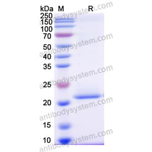 Recombinant Human FGF21 Protein, C-His