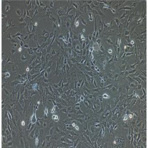 人乳腺癌细胞SUM102PT