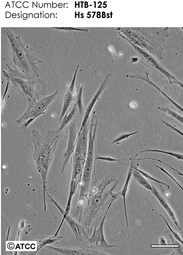 人肺鳞癌细胞HCC1588,HCC1588