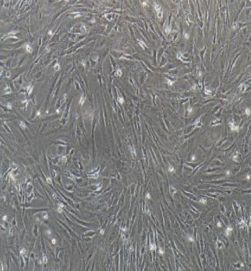 人乳腺癌细胞SUM52PE,SUM52PE