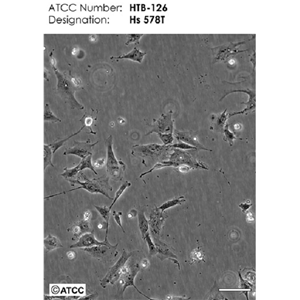 人卵巢良性肿瘤细胞Hs832.Tc,Hs832Tc