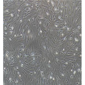 人乳腺癌细胞SUM52PE