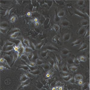 OSKZ-1小鼠诱导型多能干细胞,OSKZ-1